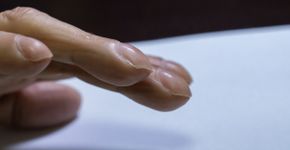 Foto: (DouglasOlivares/istock)
