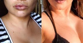 Influencer grava vídeo denunciando espancamento