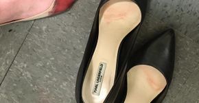 Garçonete mostra pés sangrando por uso obrigatório de salto no trabalho