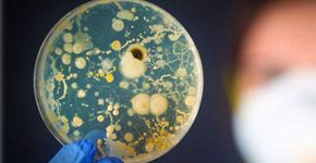 Bactéria probiótica da longevidade ajuda chegar aos 120 anos