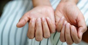 Foto: (PORNCHAI SODA/istock)