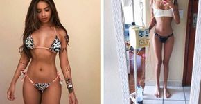 Nara Almeida mostra antes e depois após luta contra câncer raro