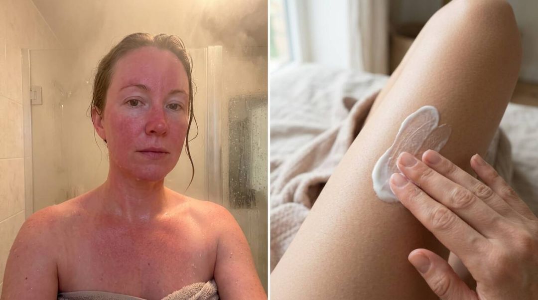 A água quente pode deixar a pele repuxando após o banho. Veja como ajustar a temperatura, escolher o sabonete e aplicar hidratante no momento certo.