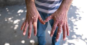 Foto: (Mustafa Kaya/istock)
