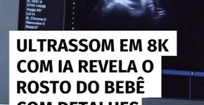 Ultrassom em 8K com inteligência artificial revela o rosto do bebê com detalhes impressionantes