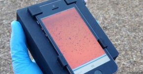 Sistema permite que smartphone identifique parasitas