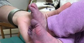 Foto: (Cleveland Clinic Children\'s Hosp SWNS)