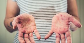 Foto: (iStock/lolostock)