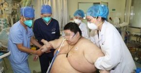 Foto: (Zhongnan Hospital of Wuhan University)