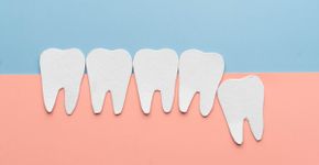 Dente do siso: por que algumas pessoas não têm?