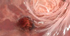 Foto: (Dr_Microbe/istock)