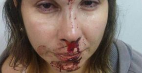 Filho usa redes sociais para denunciar agressão do pai contra mãe