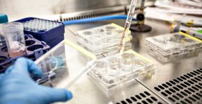 Laboratório encerra estudo avançado sobre vacina contra HIV