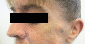 Foto: (New England Journal of Medicine)