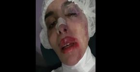 Transexual crucificada na Parada LGBT foi agredida novamente