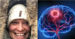 Foto: (Tumor Brain Research/peterschreiber.media/istock)