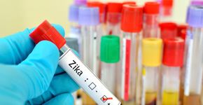 Zika pode provocar distúrbio no fundo do olho das crianças