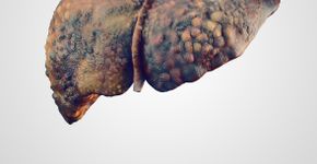 Foto: (eranicle/istock)