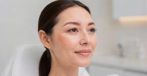 Botox vs Preenchimento, para que serve cada um e qual a idade certa para começar?