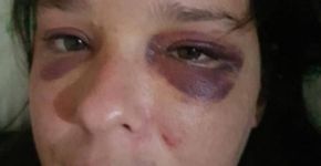 Mulher é espancada por apoiadores de Bolsonaro em Recife