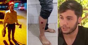 Jovem se veste de palhaço macabro e leva balas de borracha da PM