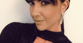 Graciele Lacerda compartilha tratamento estético em rede social