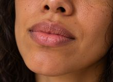 Featured side: Nem sempre é falta de hidratação: 5 motivos que deixam os lábios constantemente ressecados mesmo usando balm