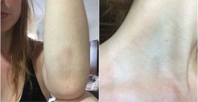 ‘Fui abusada e agredida em um bloco de Carnaval’, relata atriz