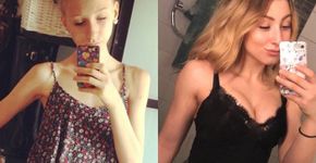 Após chegar aos 31Kg, jovem vence a anorexia e dobra o peso