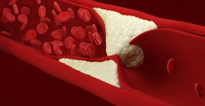 Foto: (bodym/istock)