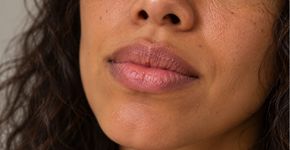 Nem sempre é falta de hidratação: 5 motivos que deixam os lábios constantemente ressecados mesmo usando balm