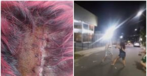 Mulher é vítima de agressão após bloco de Carnaval no AM