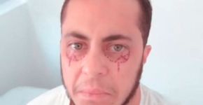 Thammy Miranda aposta em tatuagem para camuflar olheiras