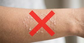 Tomar banhos muito quentes e demorados para relaxar pode piorar o ressecamento da pele: na Austrália, especialistas recomendam evitar água excessivamente quente e manter os banhos mais curtos