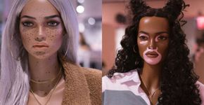 Marca adota manequins com estrias, sardas, pintas e vitiligo