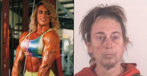 Mulher bombada fica com rosto masculino