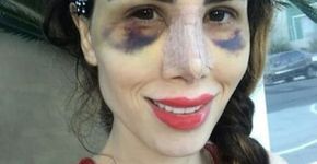 Após piora, empresário de Camilla Uckers pede ajuda no Instagram