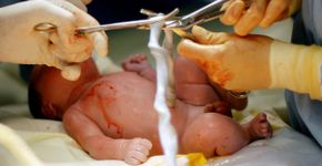 Foto: (iStock/ChenRobert)