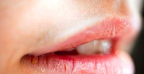 Foto: (wakila/istock)