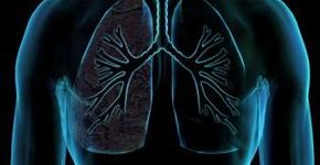 Aprenda a identificar e a tratar da tuberculose