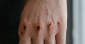 5 sinais na pele podem indicar doença grave