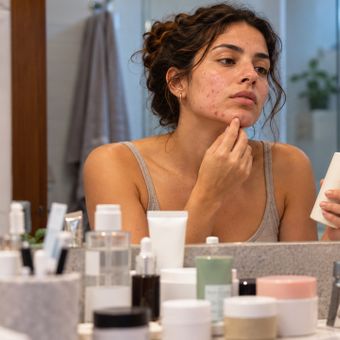 Featured mobile: Acne em adultos: alterações hormonais e resistência à insulina podem influenciar o surgimento de espinhas além do consumo de chocolate
