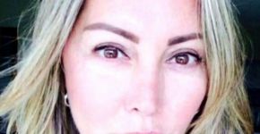 O terrível antes e depois desse rosto ensina o que é feminicídio