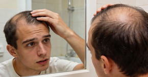 Uma pessoa em particular da sua família determina se você vai perder cabelo e não é o seu pai