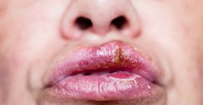 Foto: (Ejla/istock)