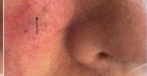 Foto: (divulgação/Dermatologia Prática & Conceitual)