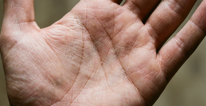 O que significa o “M” na palma da mão? A explicação da ciência e do misticismo