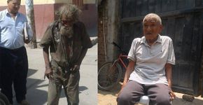 Vizinhos se unem para ajudar na recuperação de morador de rua com esquizofrenia