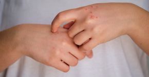 Foto: (Ladanifer/istock)