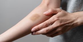 8 sintomas ocultos que podem estar associados ao câncer